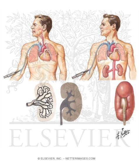 Nephrotomography