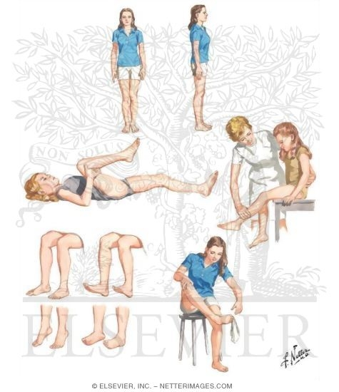 Lower limb exercises deals