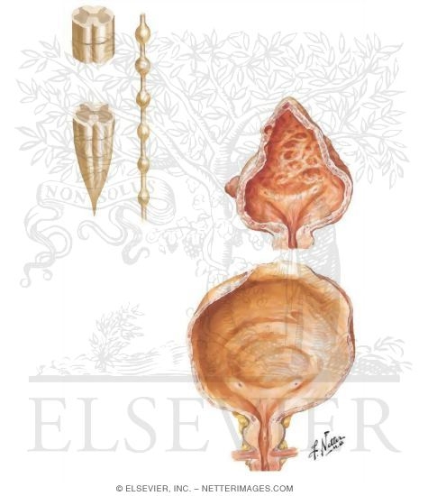 Watermarked preview of unlabeled image: Neurogenic Disorders of the Urinary Bladder