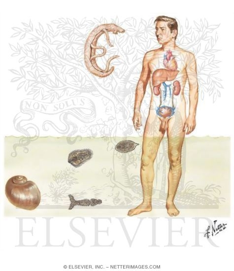 Urinary Schistosomiasis