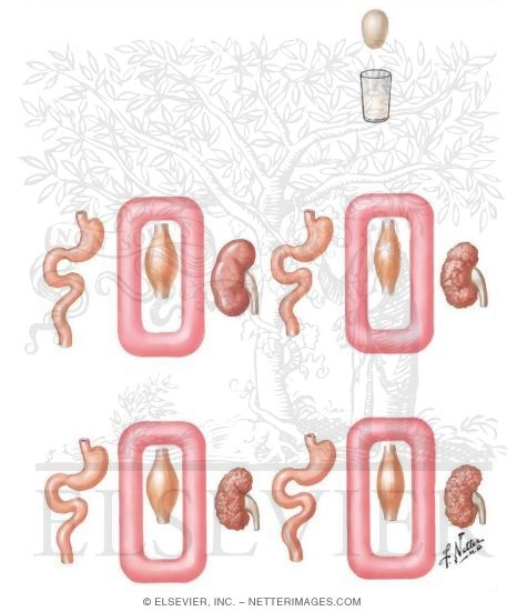 Watermarked preview of unlabeled image: Dietary Management of Renal Failure