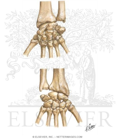 Carpal Bones
