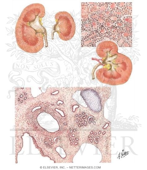 Watermarked preview of unlabeled image: Renal Dysplasia