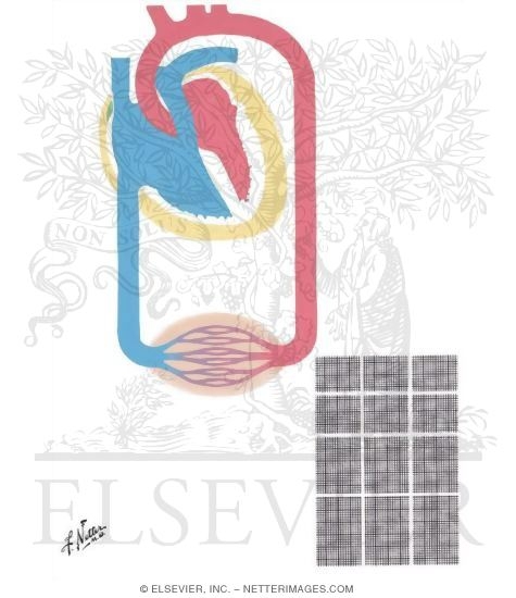 Watermarked preview of unlabeled image: Heart in Myxedema