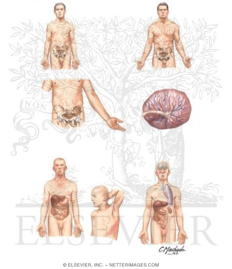 Hematopoietic Stem Cell Transplantation