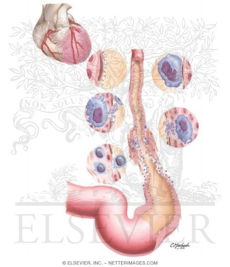 Mechanisms of Arteriogenesis and Development of Collateral Vessels