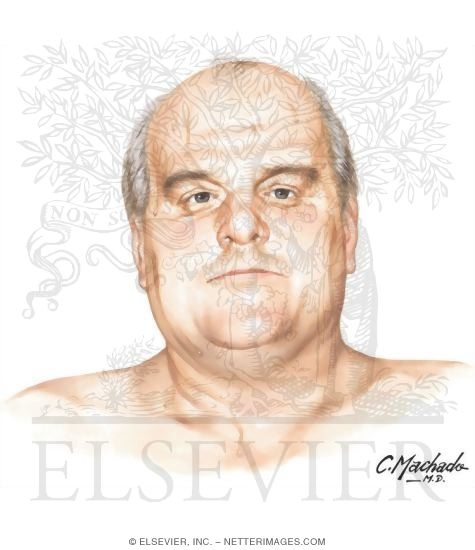 Watermarked preview of unlabeled image: Face of Overweight Man