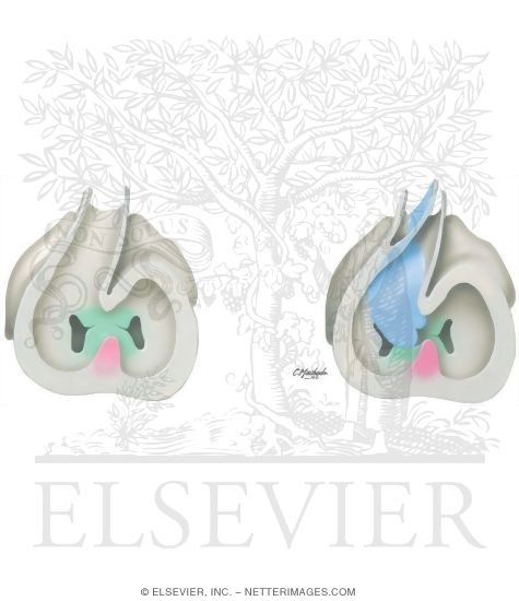 Ventricular Separation and Bulbus Cordis