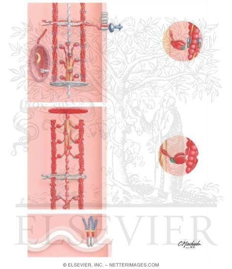 Watermarked preview of unlabeled image: Interaction of Affected Proteins in DCM, HCM, and ARVC (Cardiac Muscle Cell)