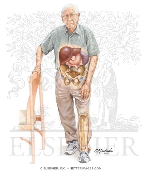 Bone Marrow Failure
