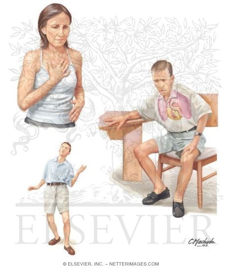 Watermarked preview of unlabeled image: Cardiac Manifestations of AIDS