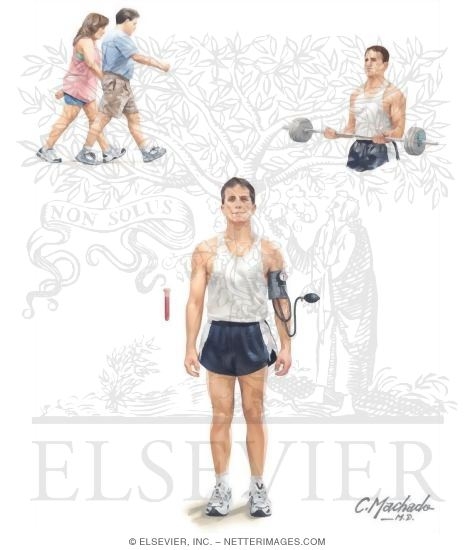 Watermarked preview of unlabeled image: Effects of Exercise on Cardiovascular Health