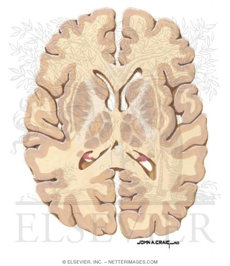 Watermarked preview of unlabeled image: Horizontal Forebrain Sections (Level 7 of 10)