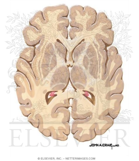 Watermarked preview of unlabeled image: Horizontal Forebrain Sections (Level 6 of 10)