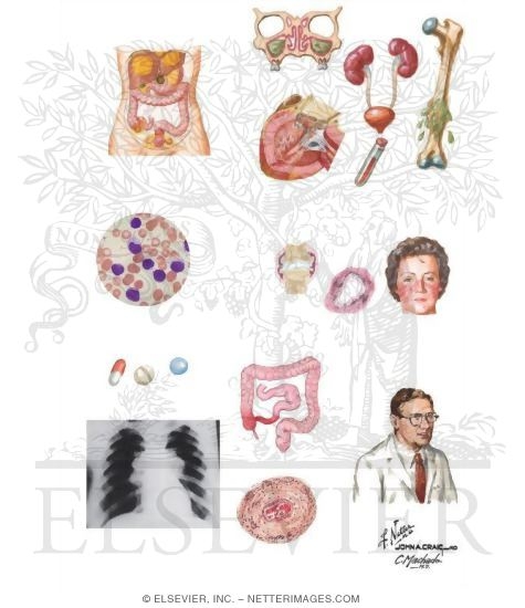 Watermarked preview of unlabeled image: Potential Causes of Fever of Unknown Origin