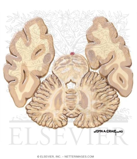 Watermarked preview of unlabeled image: Horizontal Forebrain Sections (Level 2 of 10)