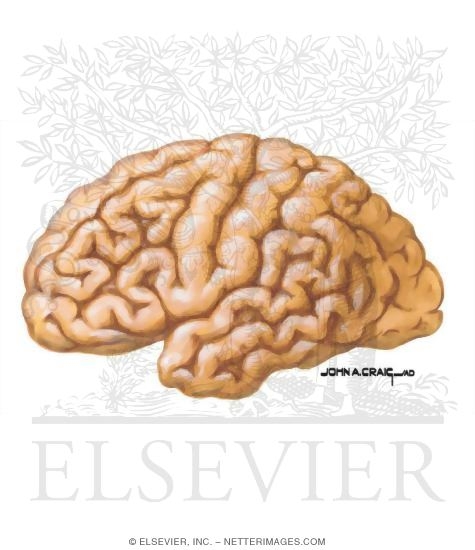 Watermarked preview of unlabeled image: Gross Pathology in Alzheimer's Disease