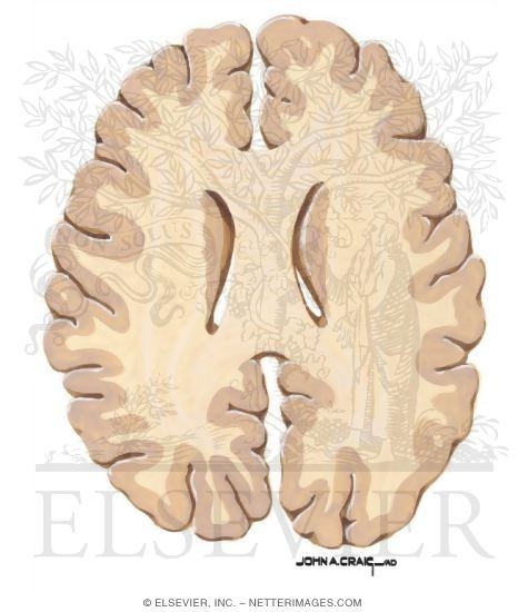 Watermarked preview of unlabeled image: Horizontal Forebrain Sections (Level 9 of 10)