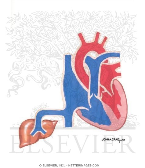 Watermarked preview of unlabeled image: Doppler Flow Studies: Comparison of Mitral and Pulmonary Vein Flow Velocities