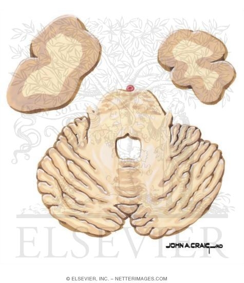 Watermarked preview of unlabeled image: Horizontal Forebrain Sections (Level 1 of 10)