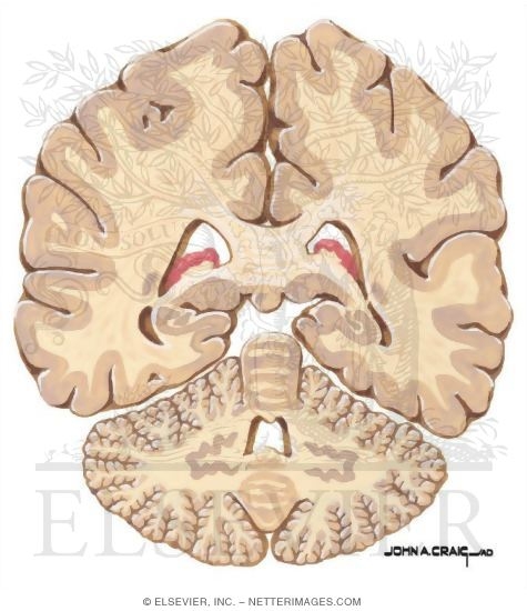 Watermarked preview of unlabeled image: Coronal Forebrain Sections (Level 10 of 10)