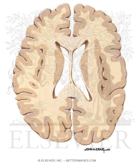 Watermarked preview of unlabeled image: Horizontal Forebrain Sections (Level 8 of 10)
