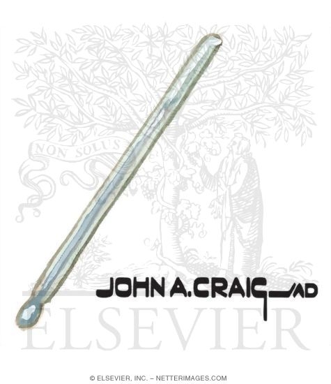 Watermarked preview of unlabeled image: Diagnostic Considerations In Fever of Unknown Origin