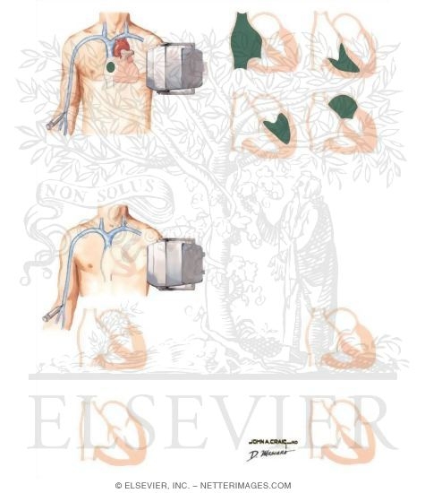 Watermarked preview of unlabeled image: Types of Functional Stress Testing