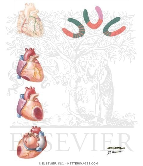 Watermarked preview of unlabeled image: Planar Perfusion Studies In Coronary Artery Disease