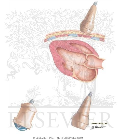 Watermarked preview of unlabeled image: Two-Dimensional Imaging