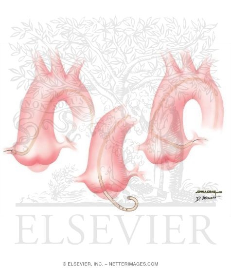 Watermarked preview of unlabeled image: Left Heart Catheterization