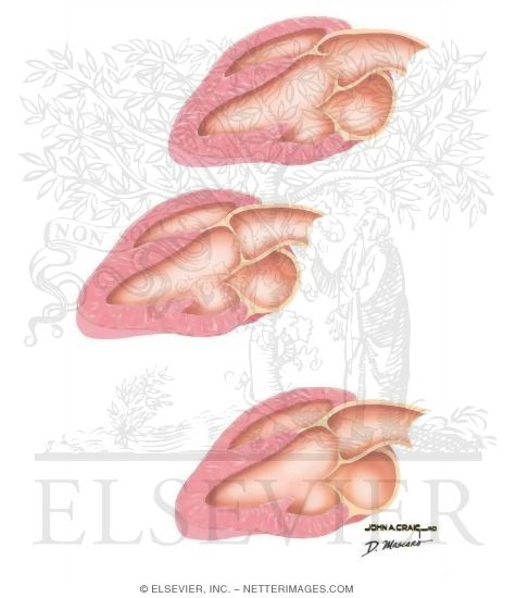 Watermarked preview of unlabeled image: Doppler Techniques In Hemodynamic Evaluation