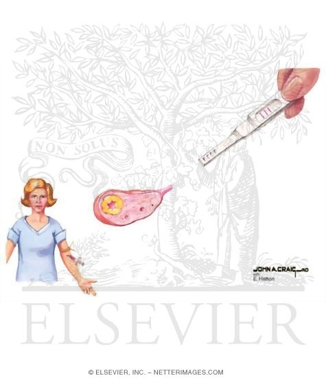 Watermarked preview of unlabeled image: Assessment of Ovulation