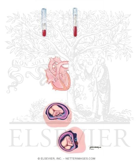 Watermarked preview of unlabeled image: Cardiovascular Adaptations to Pregnancy