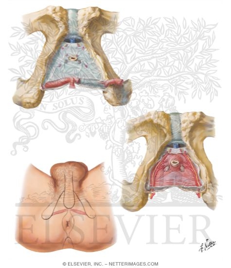 Urogenital Diaphragm
Perineal Spaces