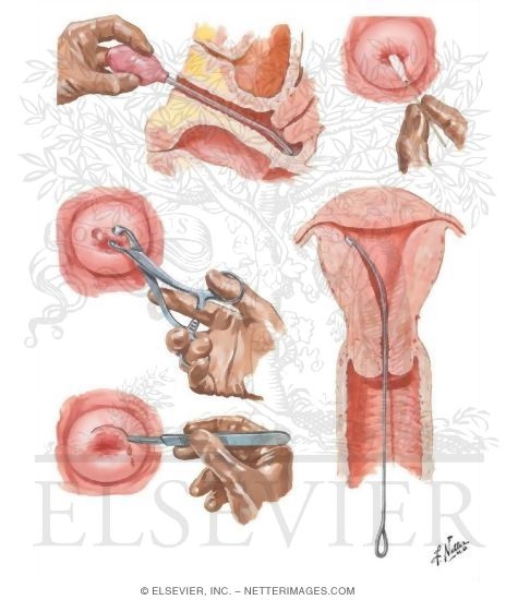 Watermarked preview of unlabeled image: Diagnostic Procedures I - Vaginal Smear, Cervical and Endometrial Biopsies