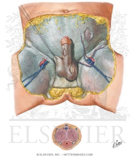 Watermarked preview of unlabeled image: Ligamentous and Fascial Support