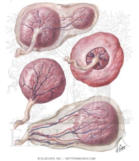 Placental Variations
