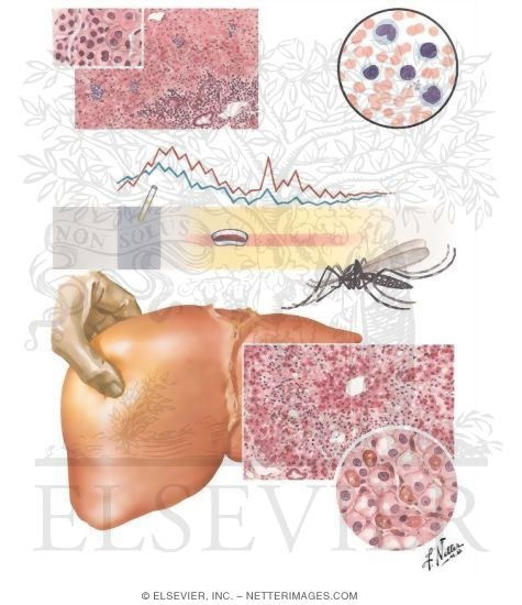 Infectious Mononucleosis, Yellow Fever