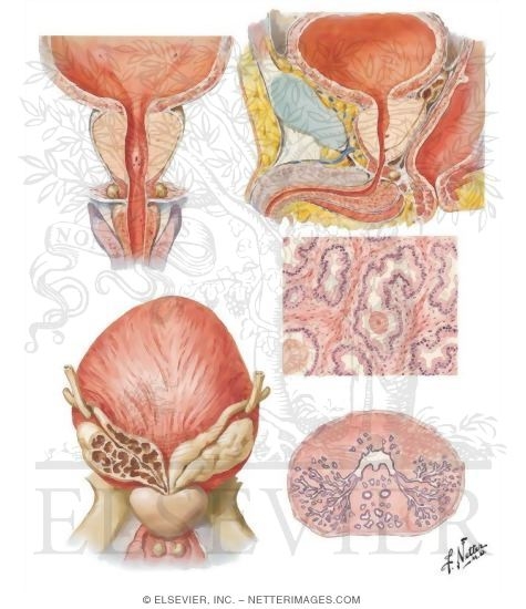 Prostate and Seminal Vesicles