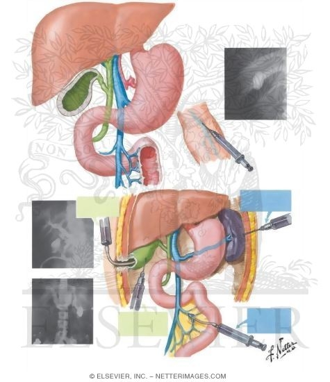 Cholecystography, Cholangiography, Portal Venography