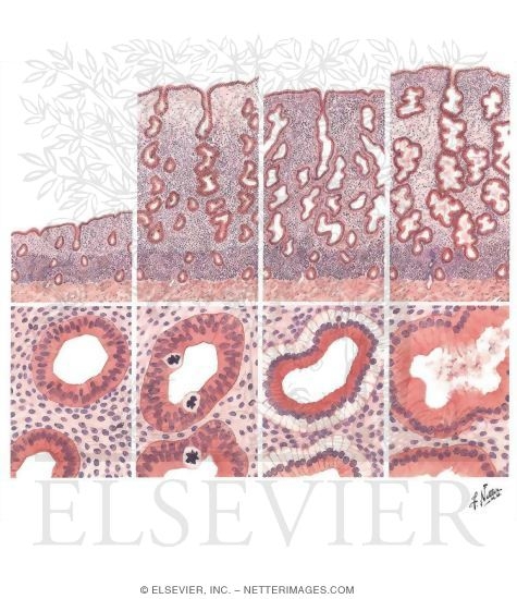 Endometrial Cycle