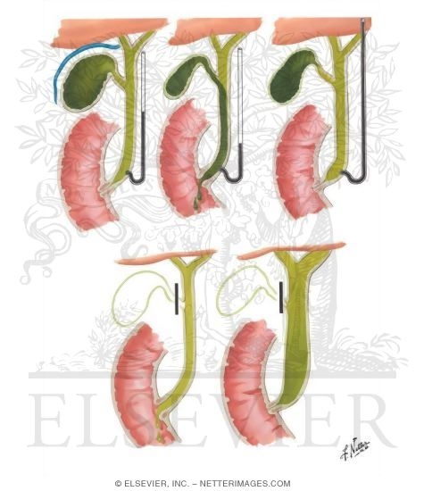 Function of Gallbladder and Choledochoduodenal Sphincter