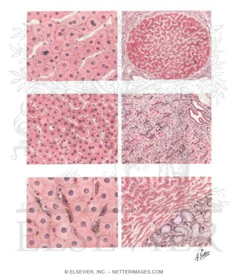 Watermarked preview of unlabeled image: Features of Hepatic Regeneration and Atrophy