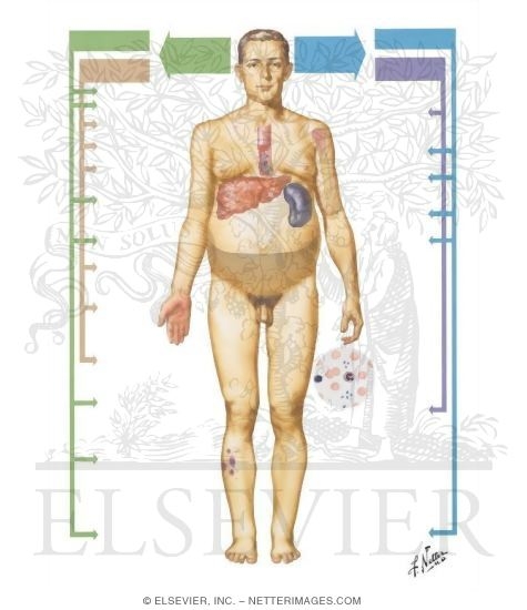 Cirrhosis III - Clinical Manifestations