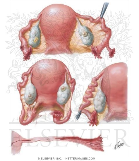 Watermarked preview of unlabeled image: Congenital Anomalies II - Atresia, Defects