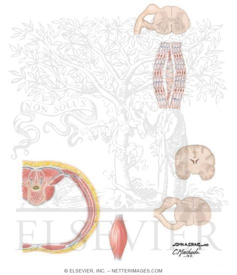 Watermarked preview of unlabeled image: Myofascial Factors in Low Back Pain