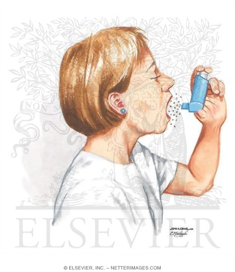 Watermarked preview of unlabeled image: Pharmacologic Management in Asthma