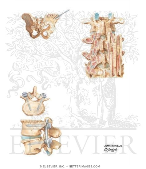 Watermarked preview of unlabeled image: Posterior Stabilization Techniques