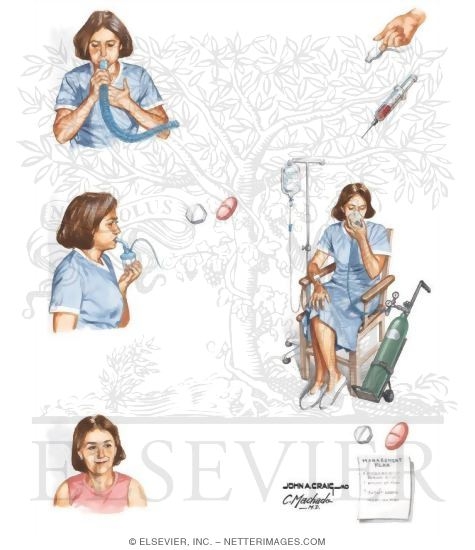 Watermarked preview of unlabeled image: Emergency Department Management in Asthma